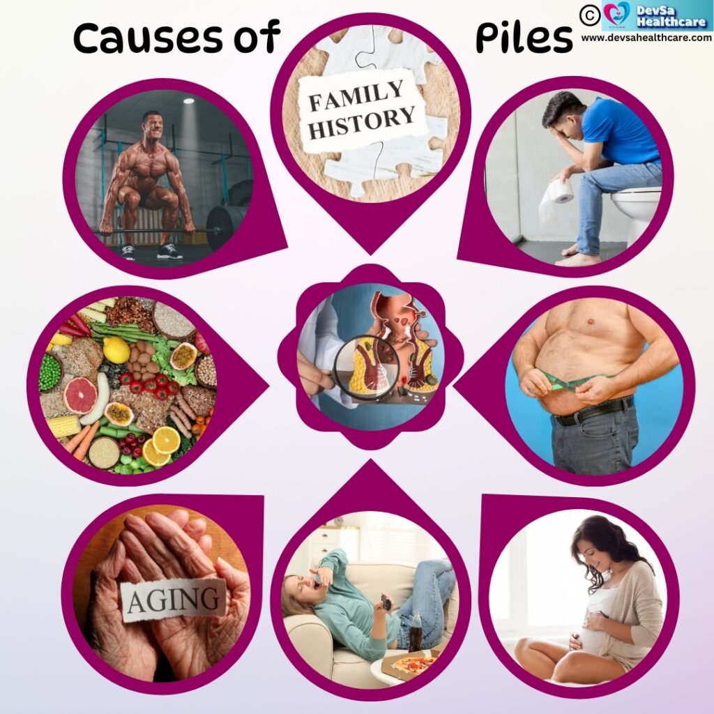 Causes of Piles by DevSa Healthcare