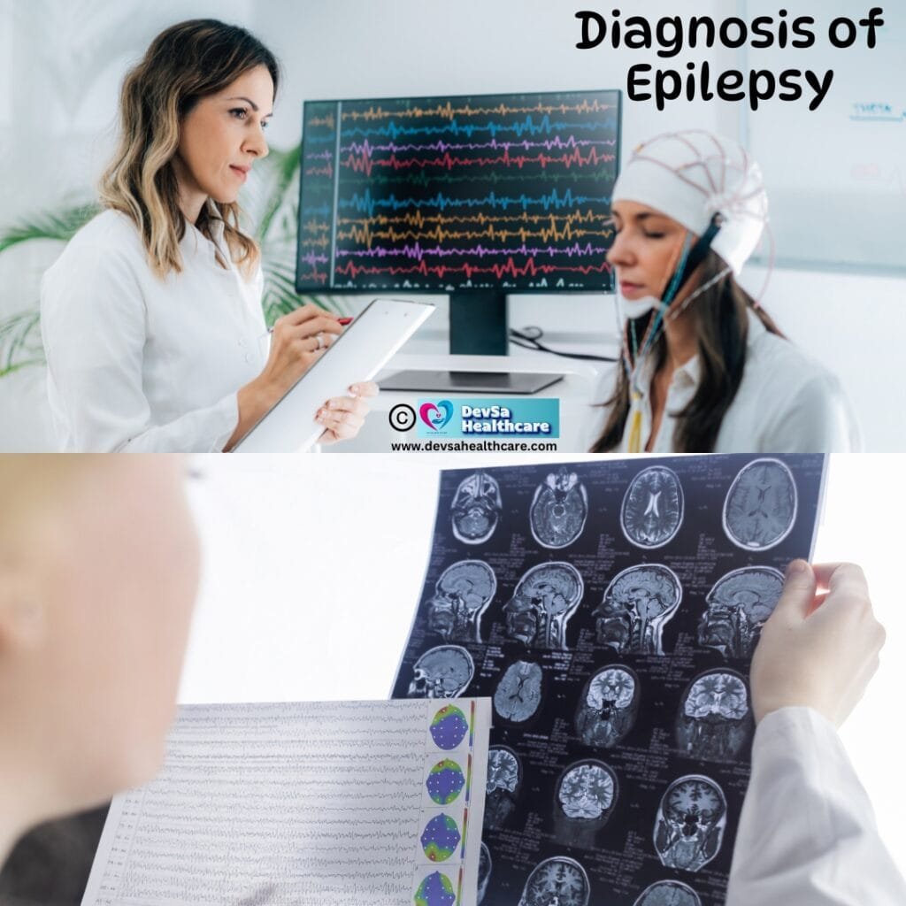 Diagnosis of Epilepsy by Devsa healthcare 