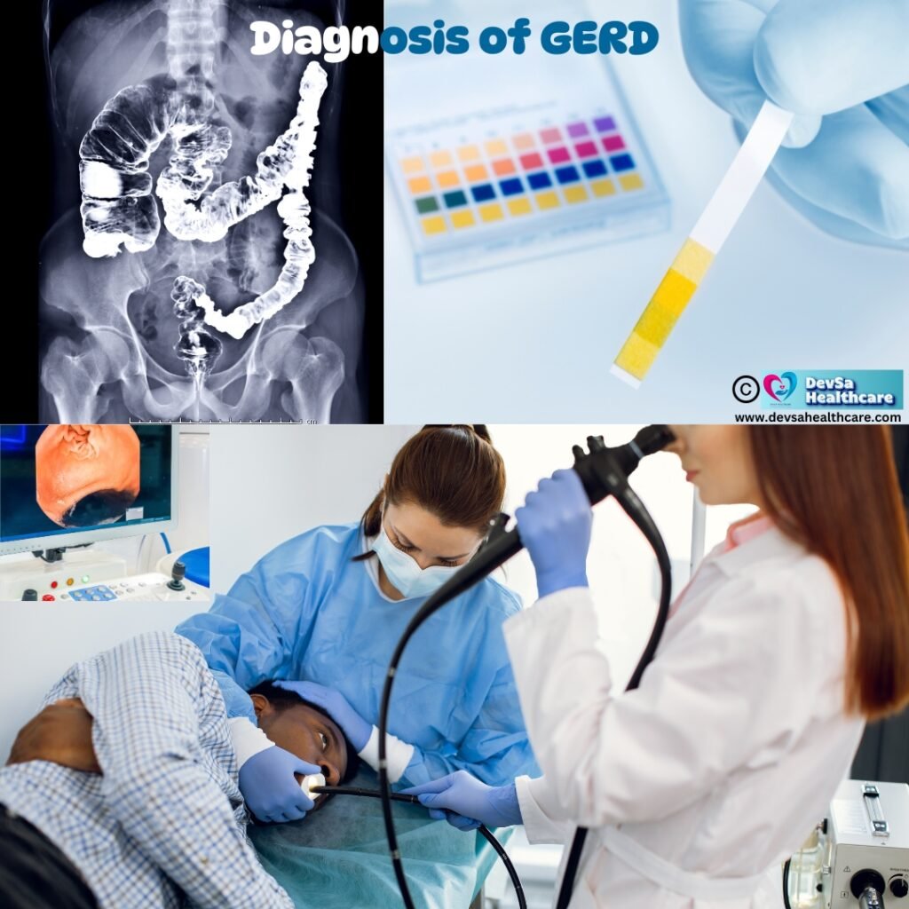 Diagnosis of GERD by DevSa Healthcare