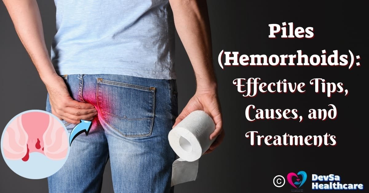 Piles (Hemorrhoids) Feature images by DevSa Healthcare