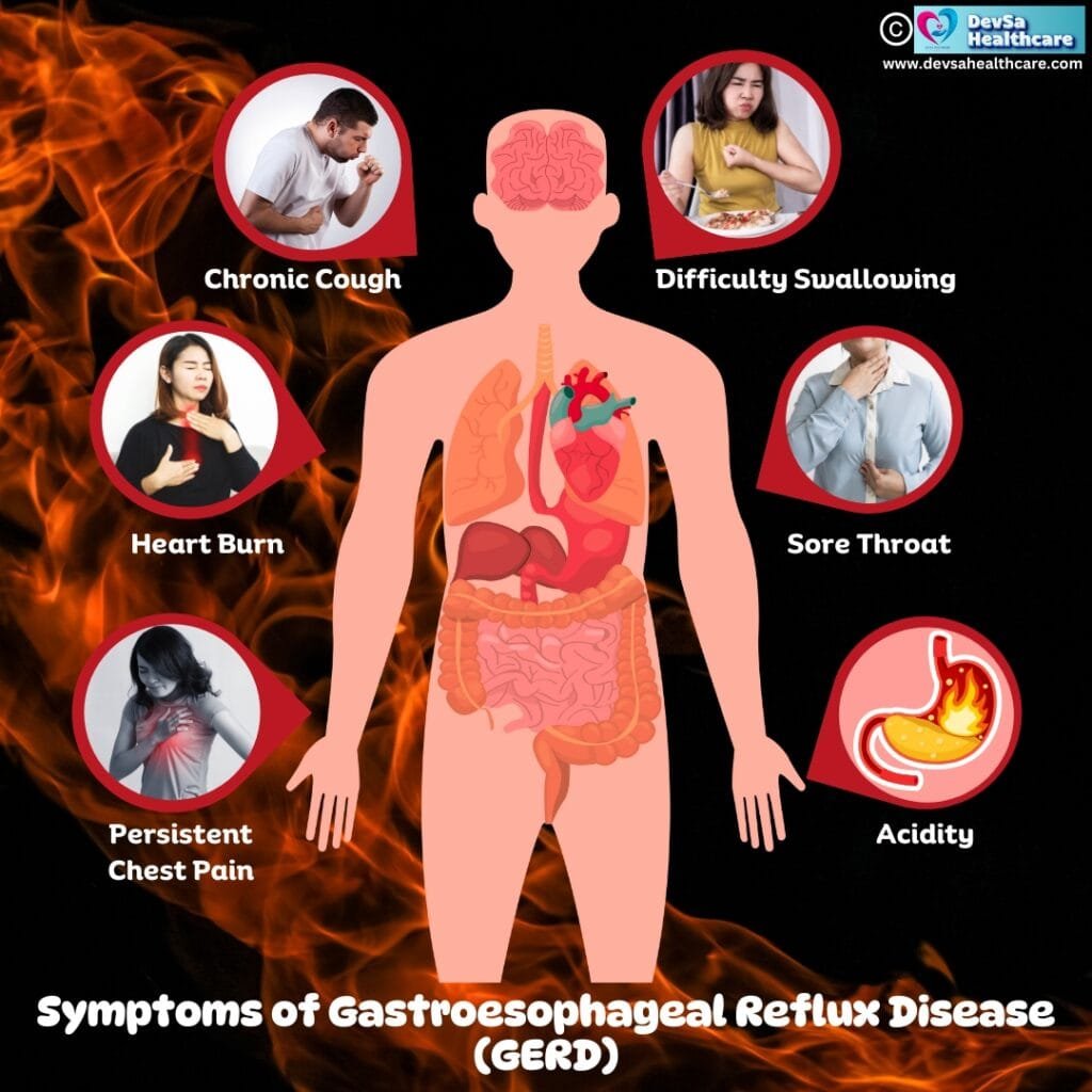 Symptoms of GERD by DevSa Healthcare