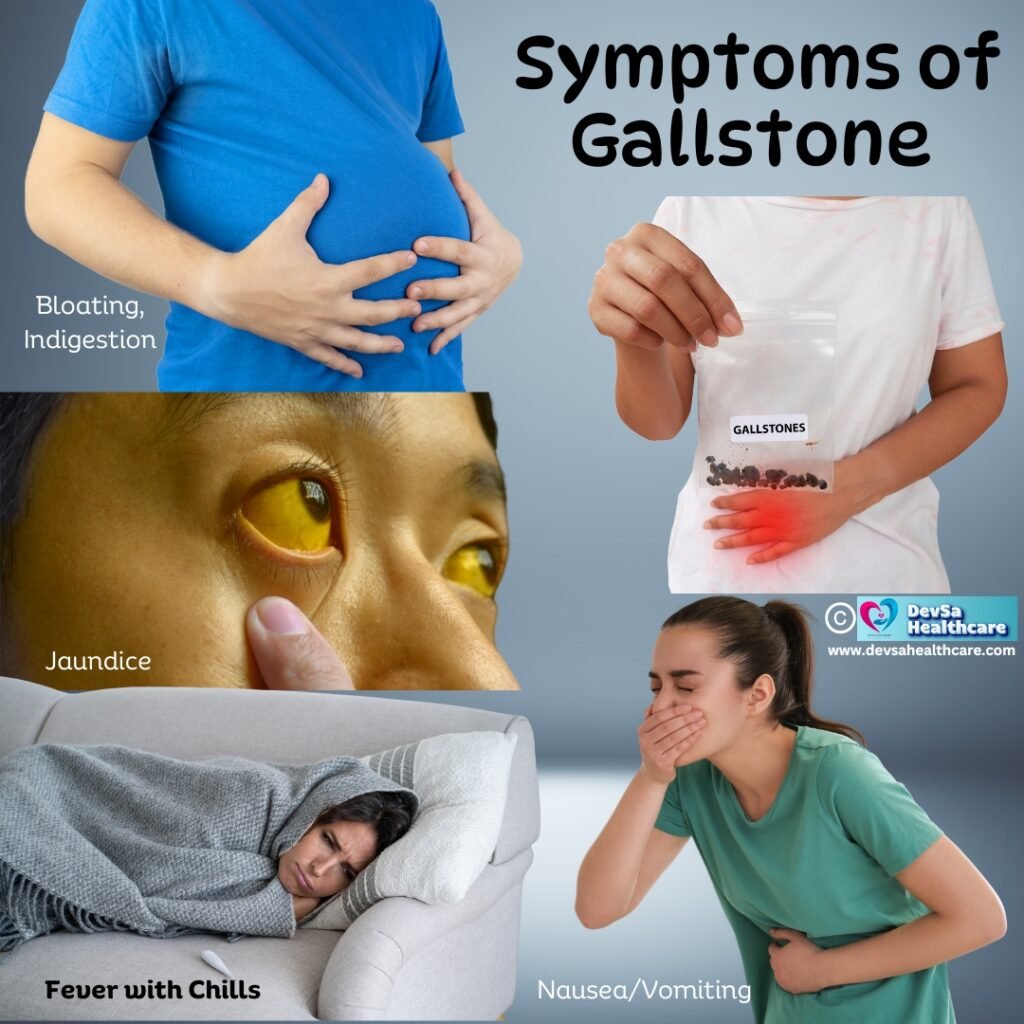 Symptoms of Gallstone by DevSa Healthcare