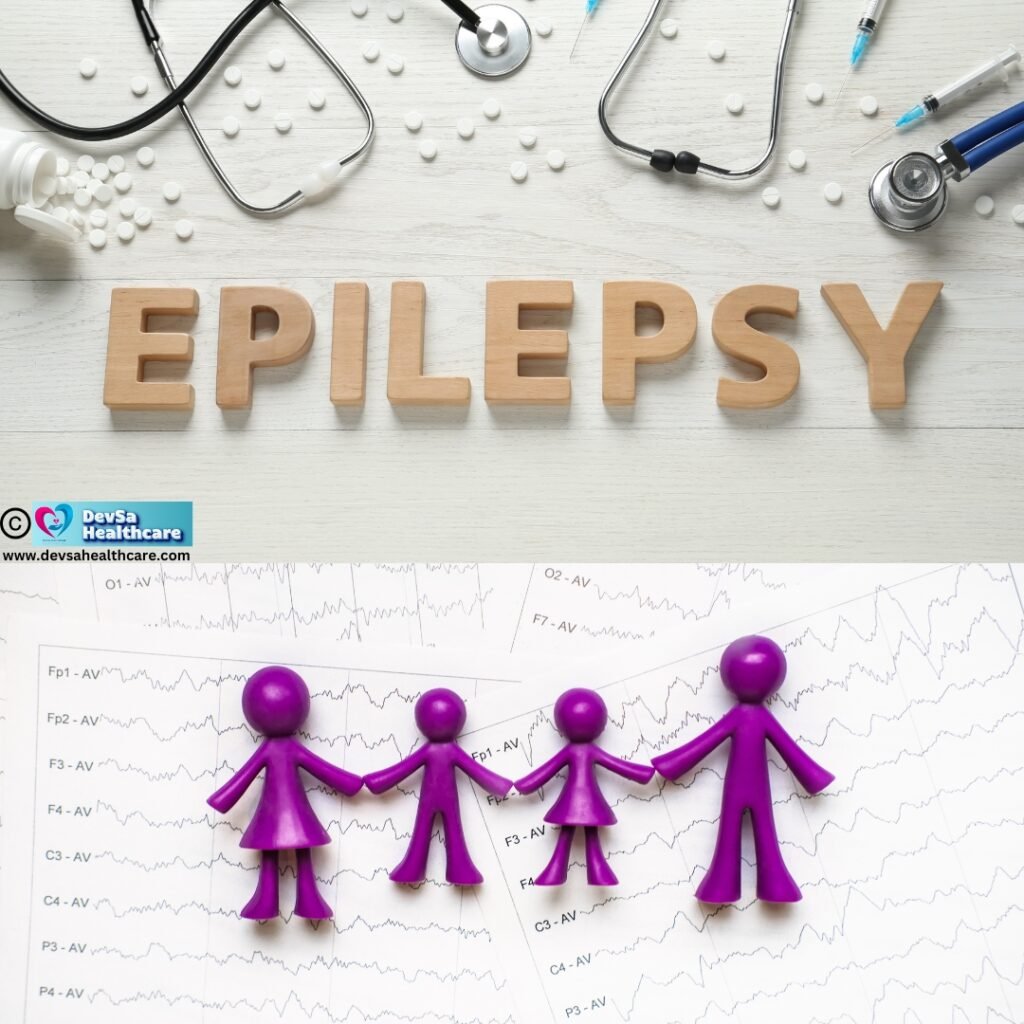 Treatment of Epilepsy by DevSa Healthcare