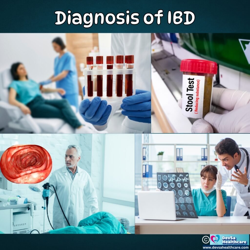 Diagnosis of Inflammatory Bowel Disease by DevSa Healthcare