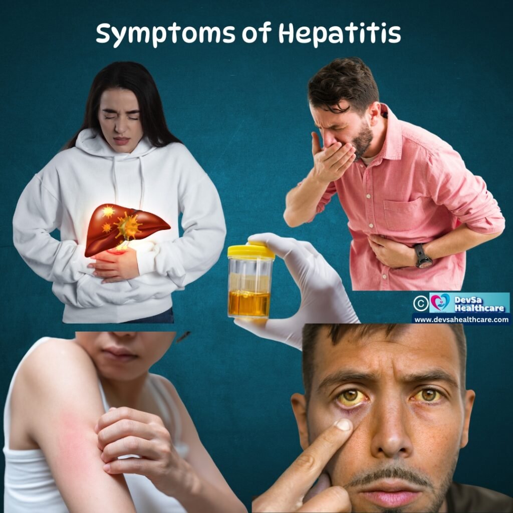 Symptoms of Hepatitis by DevSa Healthcare 