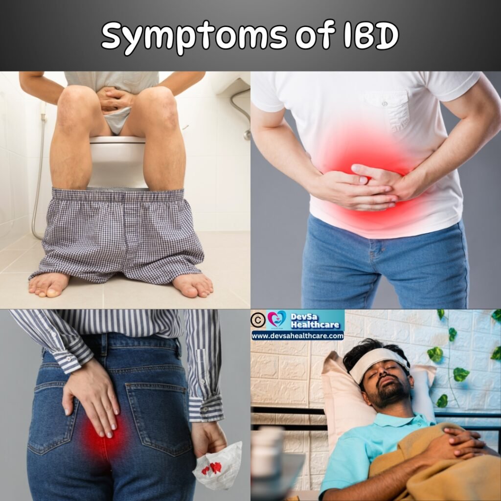 Symptoms of Inflammatory Bowel Disease